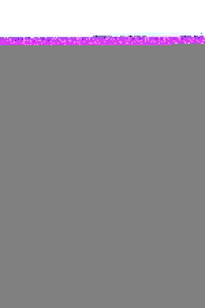 Omuz Tespit Bandajı - Velpo Bandajı - Standart Beden Yetişkin