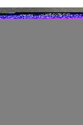 Pall Oksijen Konsantratörü Filtresi Okf-010