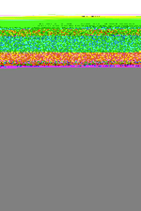 Mh Drift Ön Fren Üst Merkez N11.1052