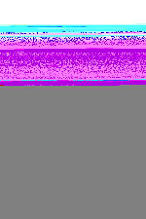 Cbf 150 Ön Fren Kolu Siyah Sağ Manet