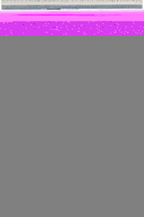 Soundwel Ts-1013 Metal Kapaklı Piezo Kare 62x62 Mm Tweeter Yedek Tweeter