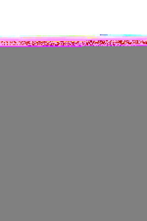 Volkswagen Beetle için Ön Cam Tamir Seti-Kapaklı-Sağ-Sol-SET