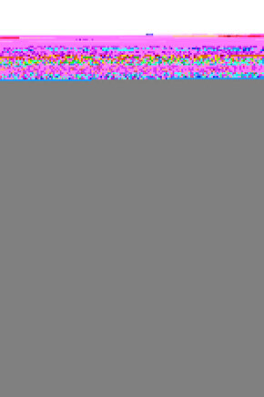 Connect için Cam Tamir Seti-Sağ-Sol-SET