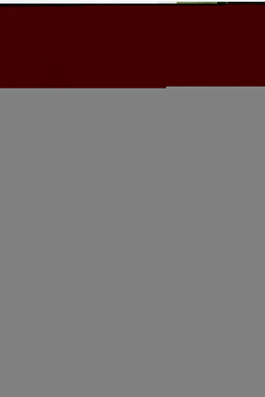 20 Metre 3d Full Hd Hdmi Tv Uydu Alıcısı Kablosu