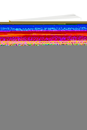 Kadın Yeşil Minimizer Toparlayıcı Sütyen 2114