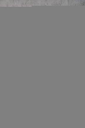 Deri Döşemeli Hasta Yaşlı Engelli Tuvaleti Ayaklı Klozet WC Yükseltici Seyyar Katlanabilir Tuvalet