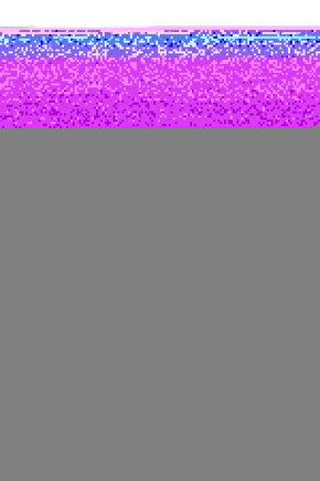 18 Watt, 6500K Beyaz Işık Led Aplik, Otel, Kafe, Bar, İşletme, Villa, Bahçe Duvar Apliği, Led Aplik