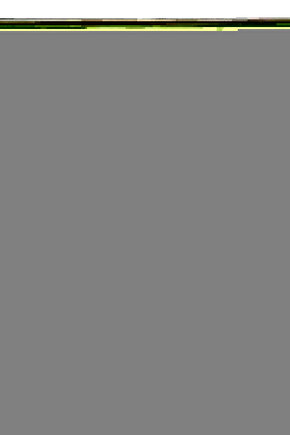 Sertifikalı Kehribar Bebek Kolyesi – Bebekler Için Doğal Rahatlama