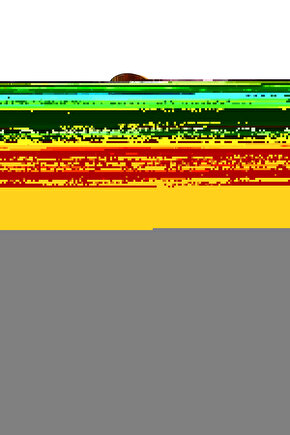 Sunup Sn-28660 Çamaşır Makinesi Tabanlık Stoper Titreşim Engelleyici Kauçuk Ped