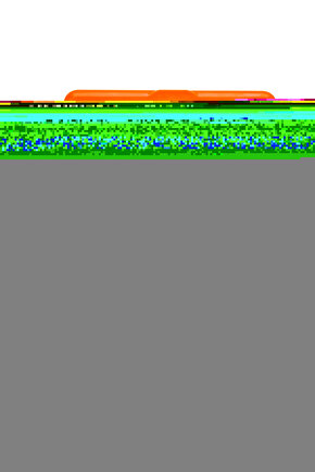 Sünger Silindir Pozisyonlama Yastık Minderleri 15x60cm