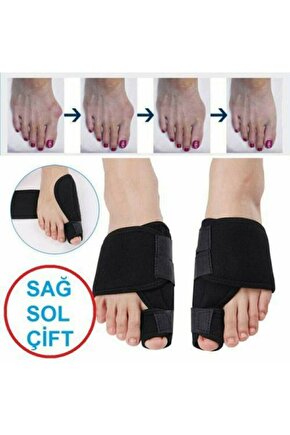 Halluks Valgus Gece Ateli Hallux Valgus Düzeltici Ayak Baş Parmak Kemiği Çıkıntısı