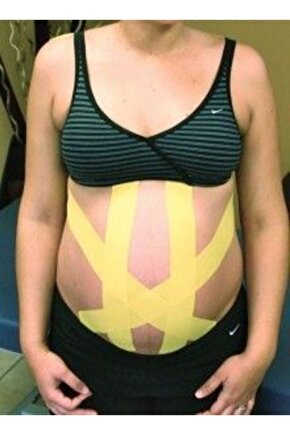 Karın Toparlayıcı Bant Göbek Destek Bandı 5cm X 5m Kinosio Tape (HAMİLELERDE KULLANABİLİR)