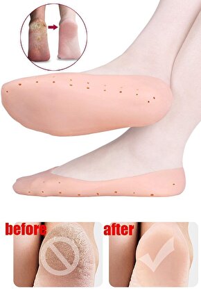 Main Shop Patik Ayak Topuk Çatlak Çorabı Ten Rengi Çorap Topuk Çatlak Giderici Ayak Bakım M-032