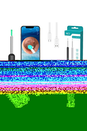 Endoskop Kamerali Kulak Temizleme Cihazi All-In-One Set (5175)