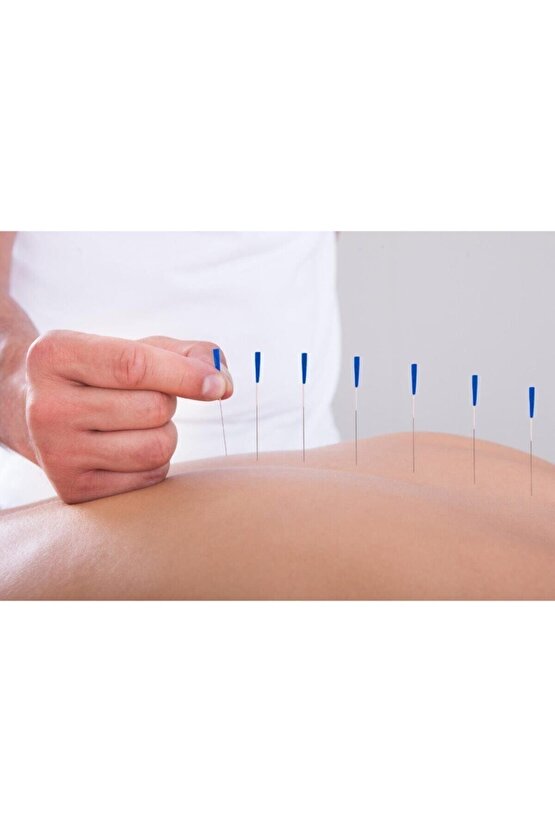 Akupunktur Iğnesi kuru Iğne,acupuncture Needle 0,18*7mm