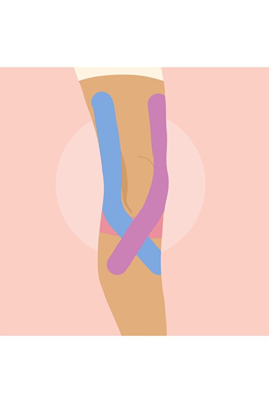 Tape Kinesio Ağrı Bandı 5 Metre X 5 Cm Kırmızı