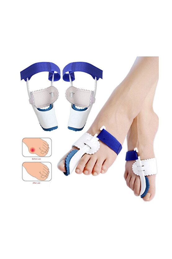 Ayak Başparmak Bunyon Halluks Valgus Gece Ateli 1 Çift