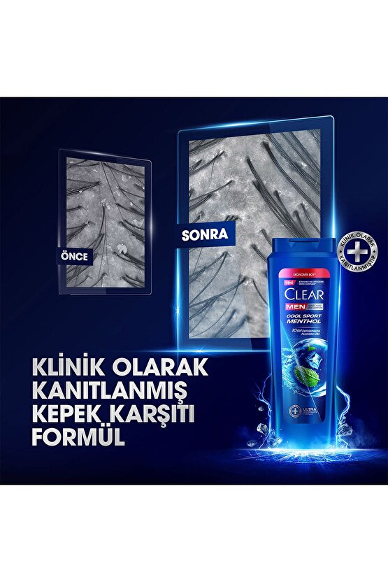 Men Kepeğe Karşı Etkili Saç Bakım Şampuanı Cool Sport Menthol Ferahlatıcı Mentol 600 ml X3