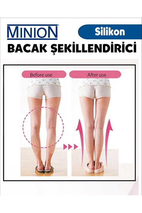 Bacaklarda Çarpıklık Giderici Bacak Şekillendirici Yapışkanlı Destek Sünger Küçük Boy