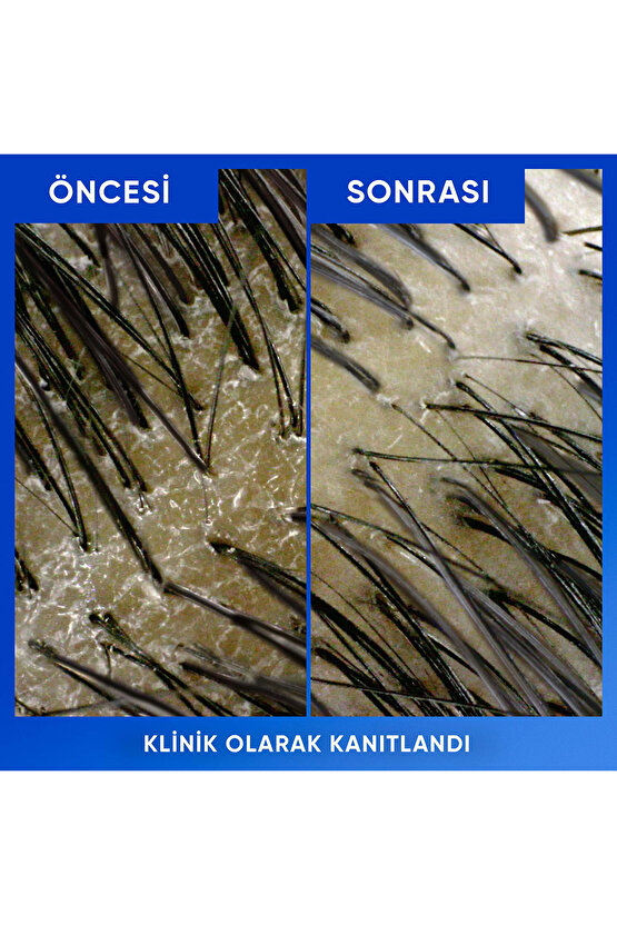 Arındırma&Parlaklık Kepeğe Karşı Etkili Şampuan 800 ml