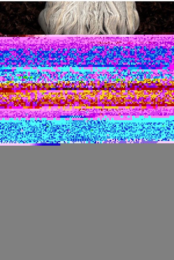 Gözenek Sıkılaştırıcı Sivilce, Leke Ve Siyah Nokta Karşıtı Niacinamide Serum 30 ml