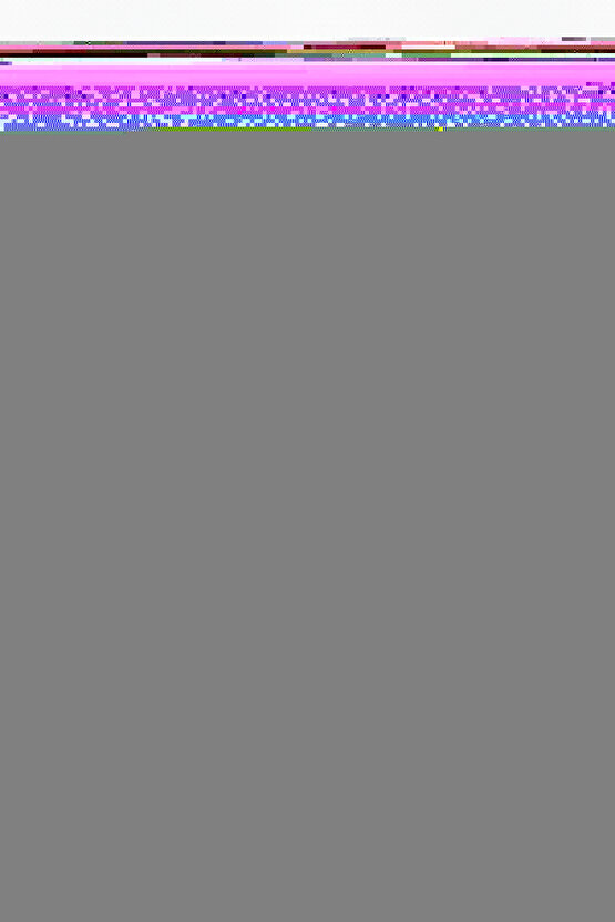 W335 Termoplastik Statik El Bilek İstirahat Splinti Sağ El