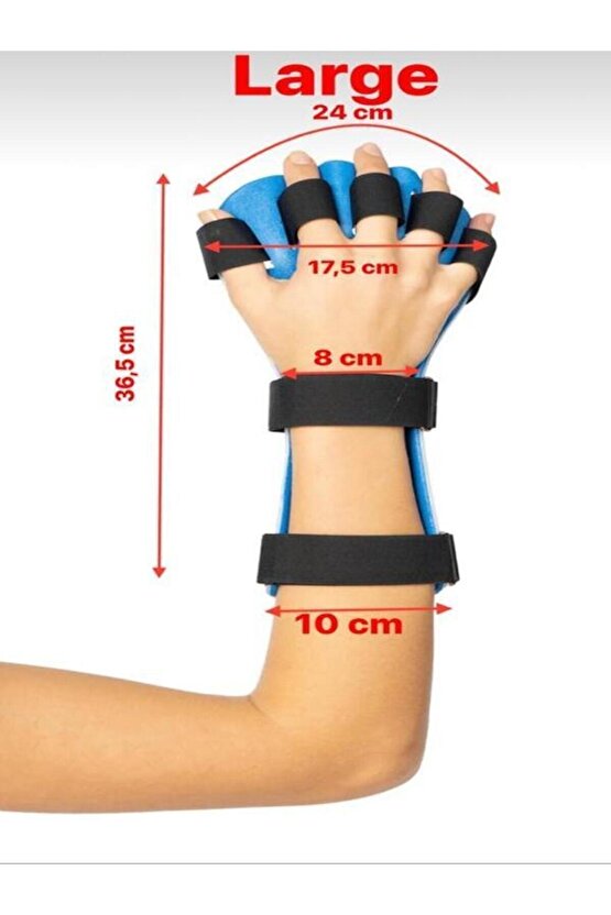 Termoplastik Antispastisite El Bileği Ve Parmak Ateli Medium Beden (SAĞ EL)