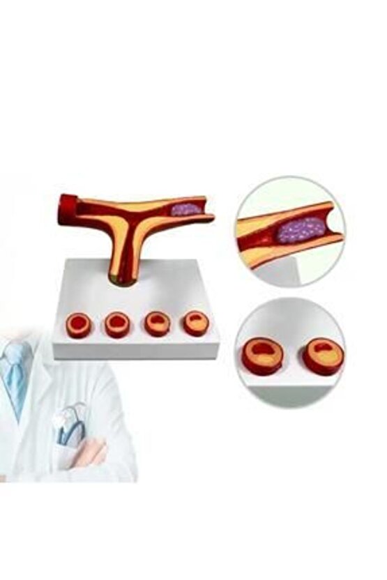 Damar Tıkanıklığı Model46