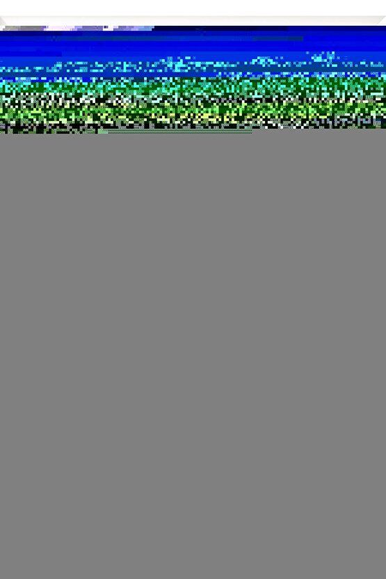 Hastanın Yatağının Baş Ucunda Sulu Wc