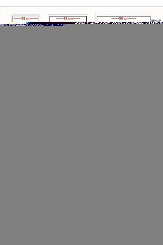 Sarı Baskılı Kolları, Beli Ve Boynu Lastikli Sweatshirt