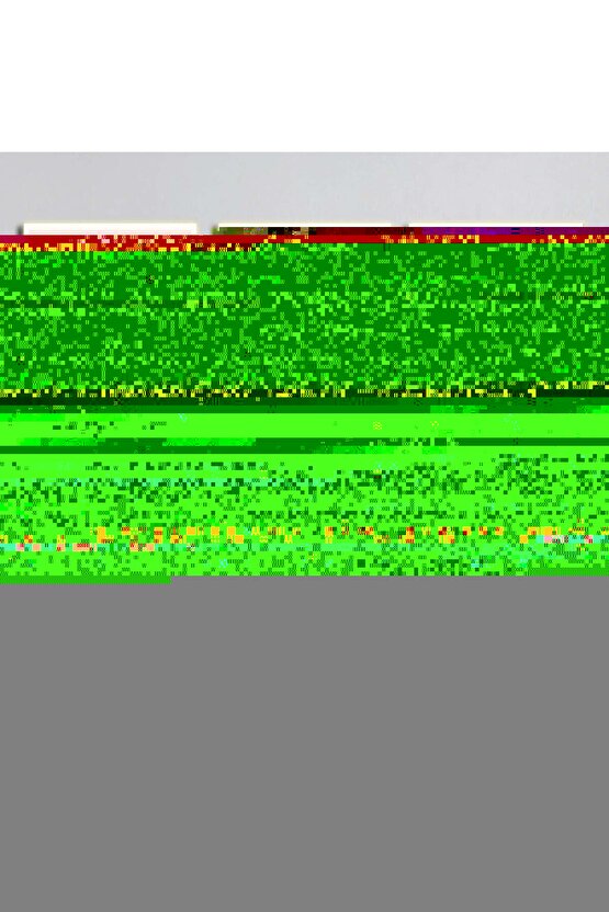 24 Watt Beyaz Işık, Çok Kaliteli Sıva Üstü Metal Kasa Tavan Armatürü, 1700 Lümen 6500 Kelvin Armatür