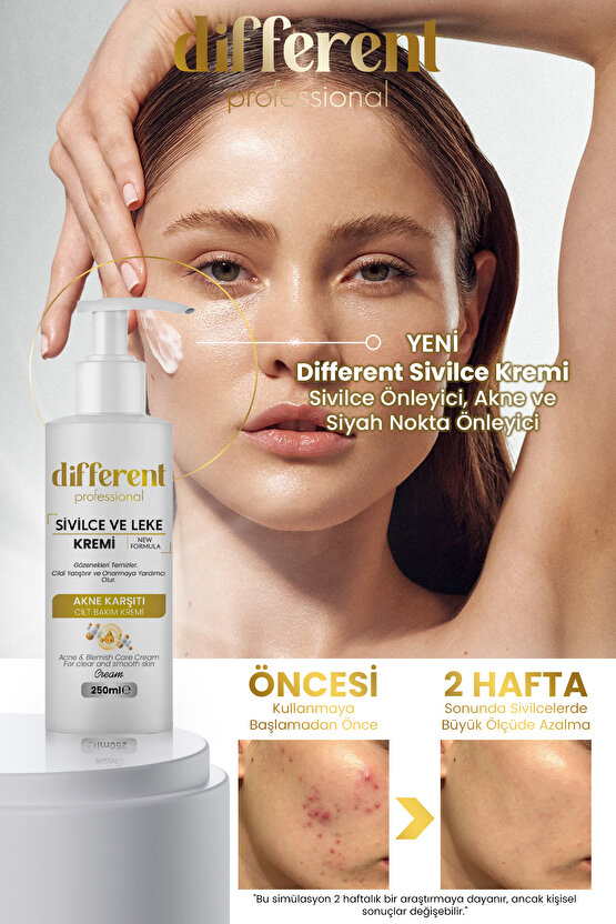 Sivilce Önleyici, Ve Sivilce Karşıtı, Akne, Siyah Nokta Leke,giderici, Yüz Kremi 250 ML