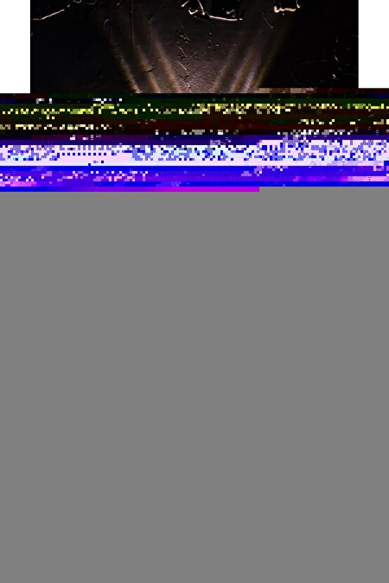 ALLİFE Tens Cihazı 16 pedli (Türkçe menü)