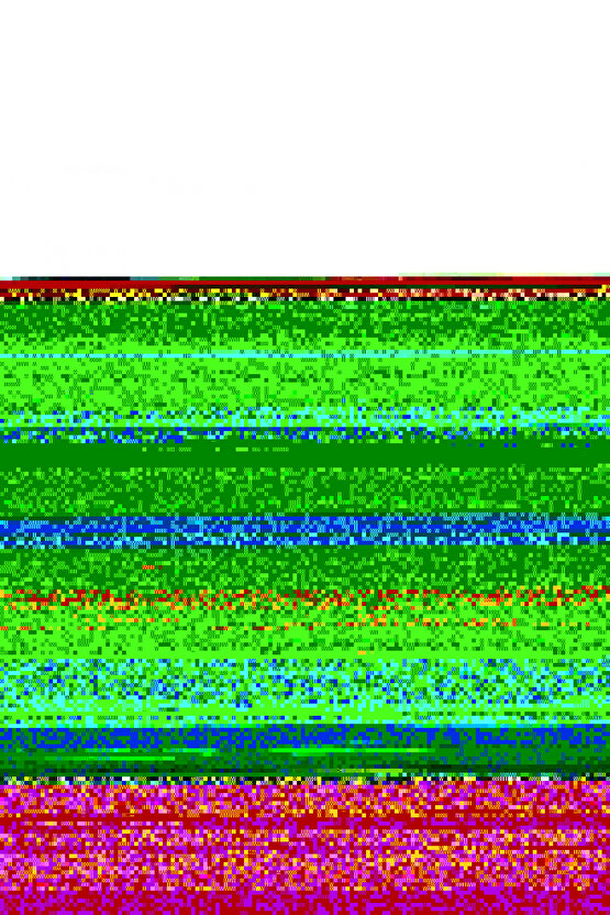 9lu Buzdolabı Düzenleyici Organizer Mikrodalga Ve Difrize Uygun Saklama Kabı Antrasit Set