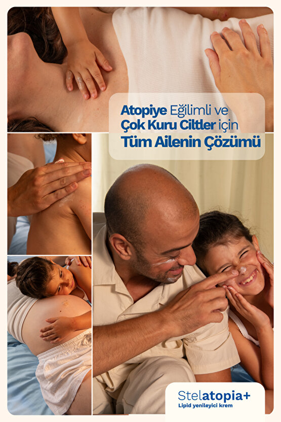 Stelatopia Cilt Bariyeri Yenileyici - Rahatlatıcı Krem 300ml