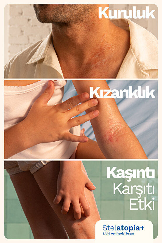 Stelatopia Cilt Bariyeri Yenileyici - Rahatlatıcı Krem 300ml