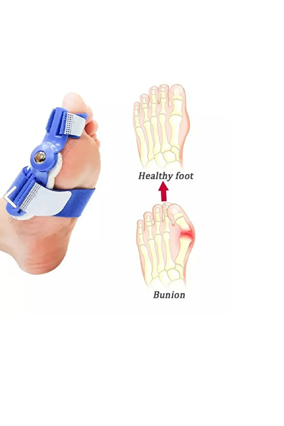Baş Parmak Kemik Düzeltici