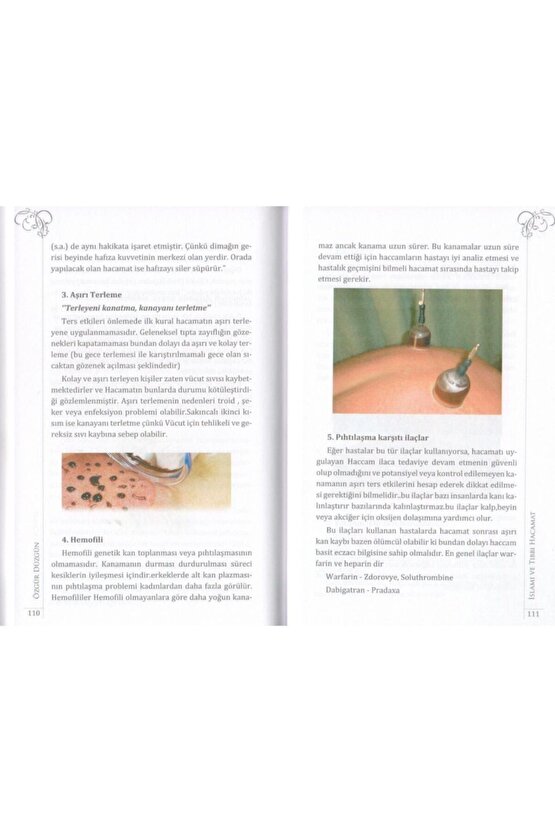 Hacamat, Islami Ve Tıbbi Tedavi Yöntemleri, Özgür Düzgün, 15x21 Cm. Mercan