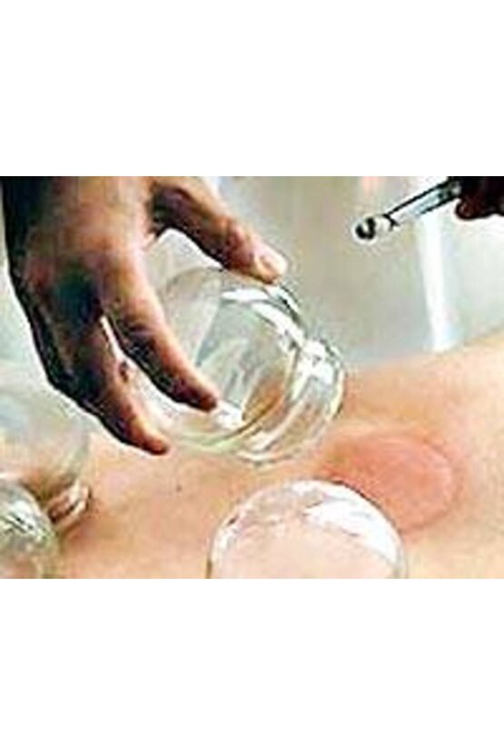 Hacamat Kupa Seti Kupa Çekme Aleti 24 Lü KUPA