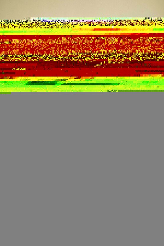 Aşil Tendon Bilekliği Örgü XL