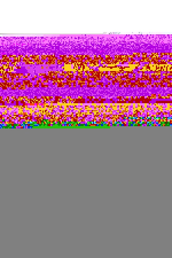 Hyundai ix35 için Uyumlu Arka Cam Tamir Seti-Sağ-Sol-SET