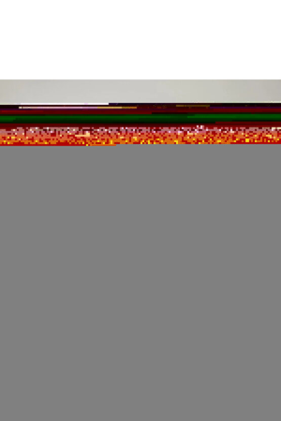 Kuru Iğne 0.30*40mm