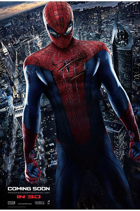 Yağ Sıçratmaz Kapak 33 cm - Isıya Dayanıklı - Üstten Tutmalı Tava Tencere Kapağı