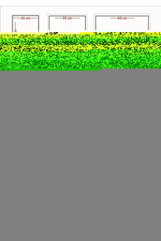 Nazal Burun Aspiratörü Yedek Uç (10 ADET)