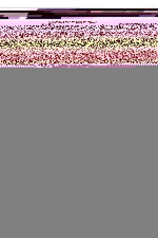 Triflo Solunum Egzersiz Cihazı - Rabır - Nefes Egzersiz Cihazı Kutusuz