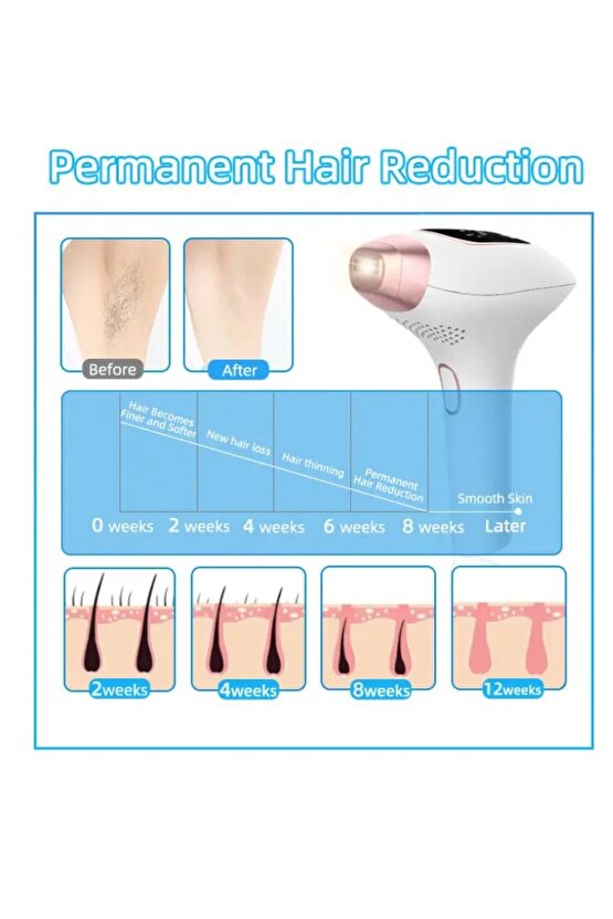 IPL BUZ LAZER EPİLASYON CİHAZI 999.999 OTOMATİK VE MANUEL ATIM 9 SEVİYE TÜM VÜCUT