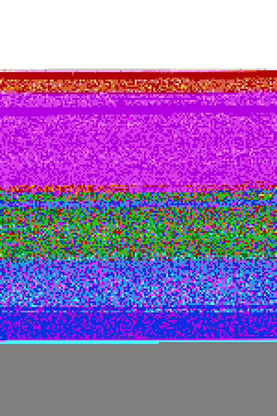 Ayset 50 ml Beslenme Enjektörü Çam Uçlu - 25li