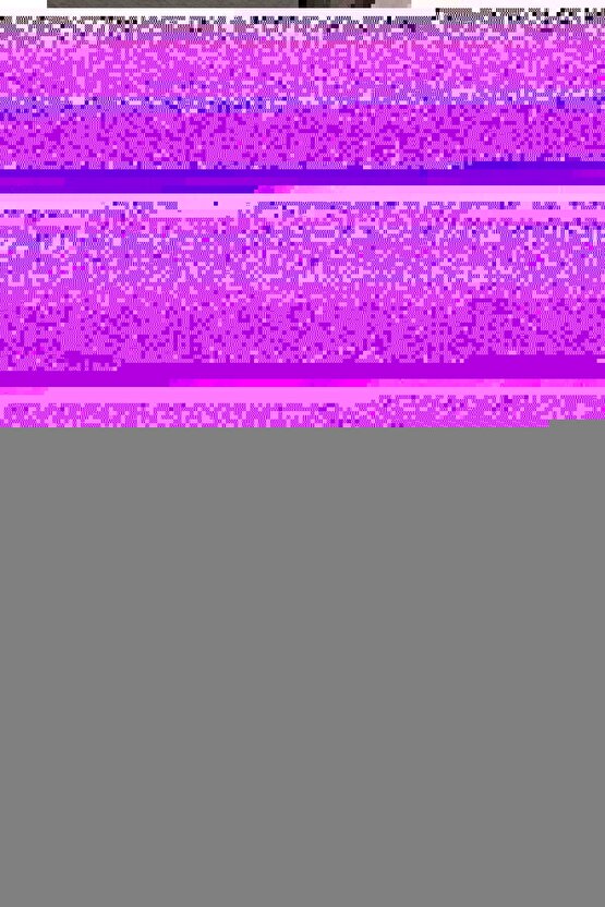 Beyaz Işık 10 W. Led Ampul Dahil Dekoratif Bahçe Duvar Aydınlatma Armatürü Set Üstü Dekoratif Aplik