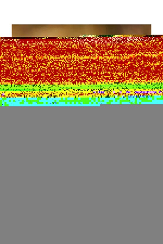 Coloplast 5 Adet 3715 Biatain Alginate 15X15CM Örtüsü