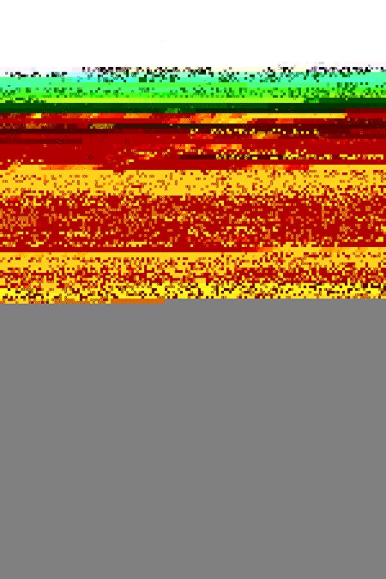 Yan Bağlamalı Çıkarılabilir Kürk Detaylı Antrasit Mini Kaban